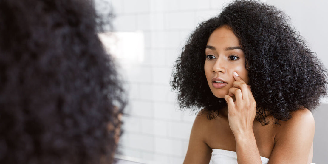 Burnt Out and Breaking Out? Here’s How Stress is Affecting Your Skin